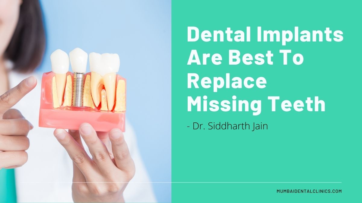 dental implant in udaipur, dentist in udaipur, replace missing teeth, missing teeth, best dentist in udaipur, best dentist in mumbai, dentist in udaipur