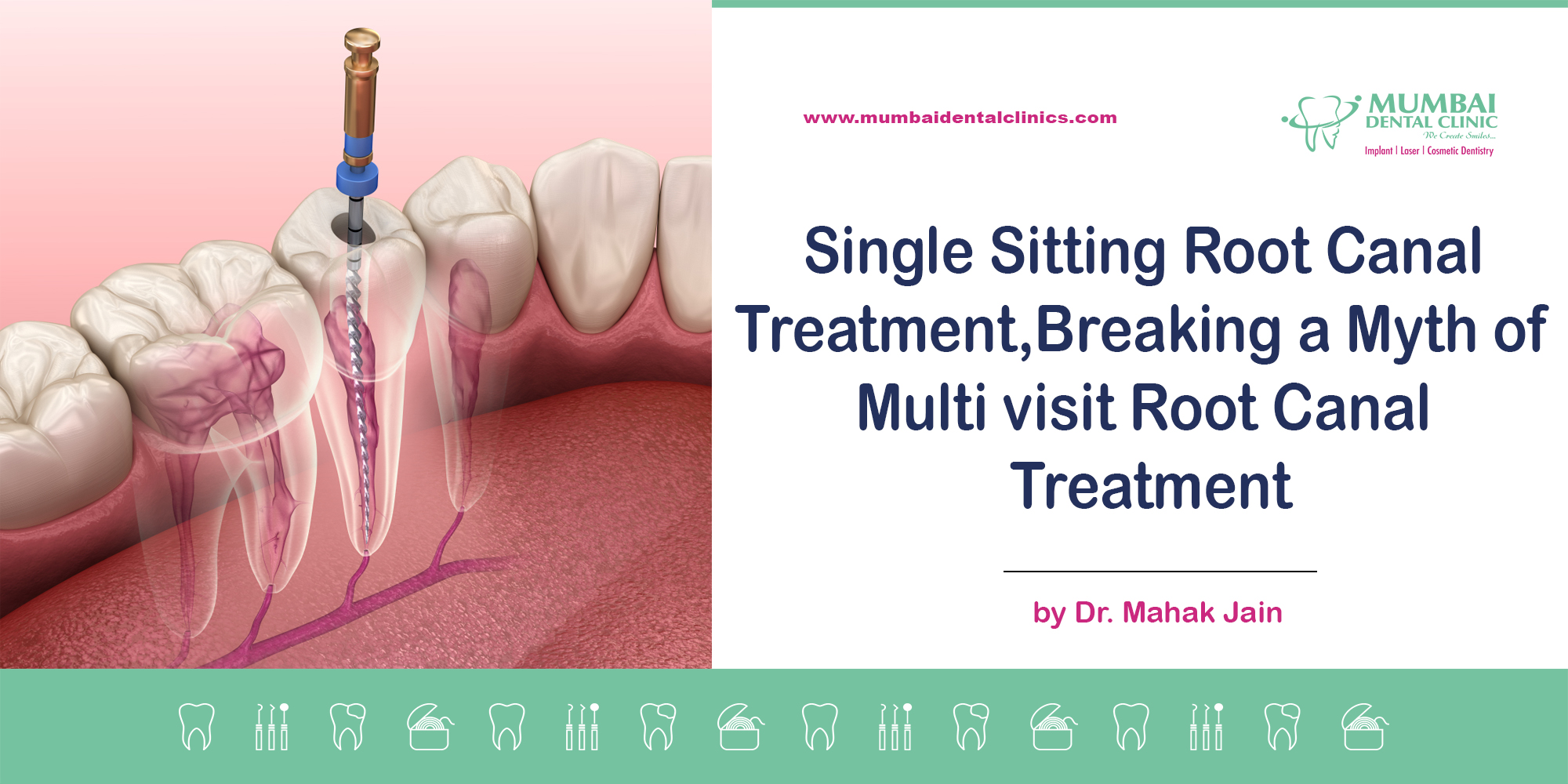 Single Sitting Root Canal Treatment,Importance of smile designing in your life, best dentist in udaipur,smile designing treatment in udaipur,Braces specialist in Udaipur,Braces doctor in Udaipur,full mouth rehabilitation treatment in udaipur