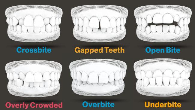 Orthodontist in udaipur