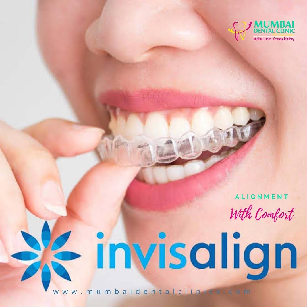 Teeth whitening in Udaipur
